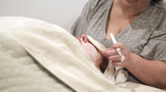 Acne Scars? Treat Them With Our Super Secret Concoctions
