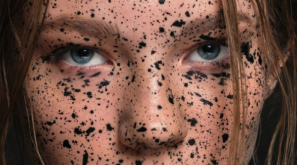 Treat Acne + Wrinkles at the Same Time With These Tips