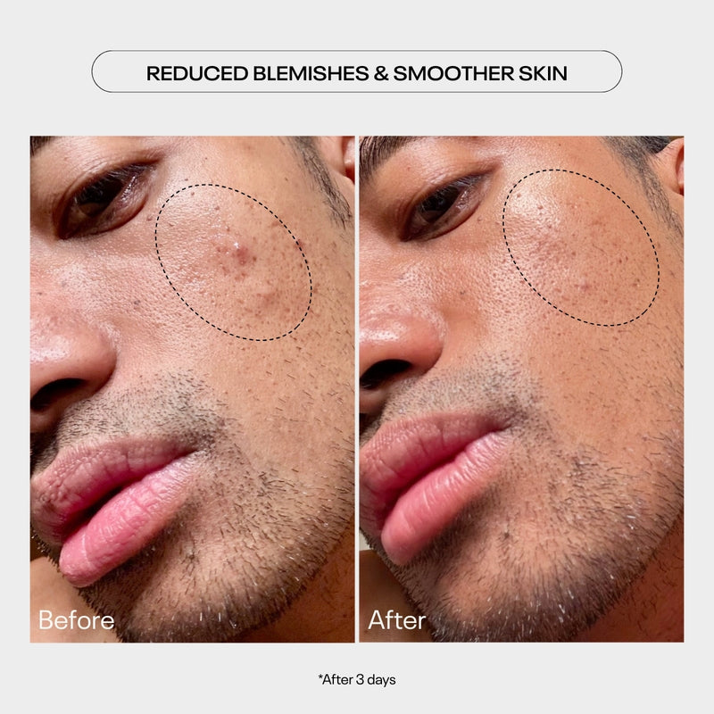 AHA Moment Double Action Resurfacing Serum