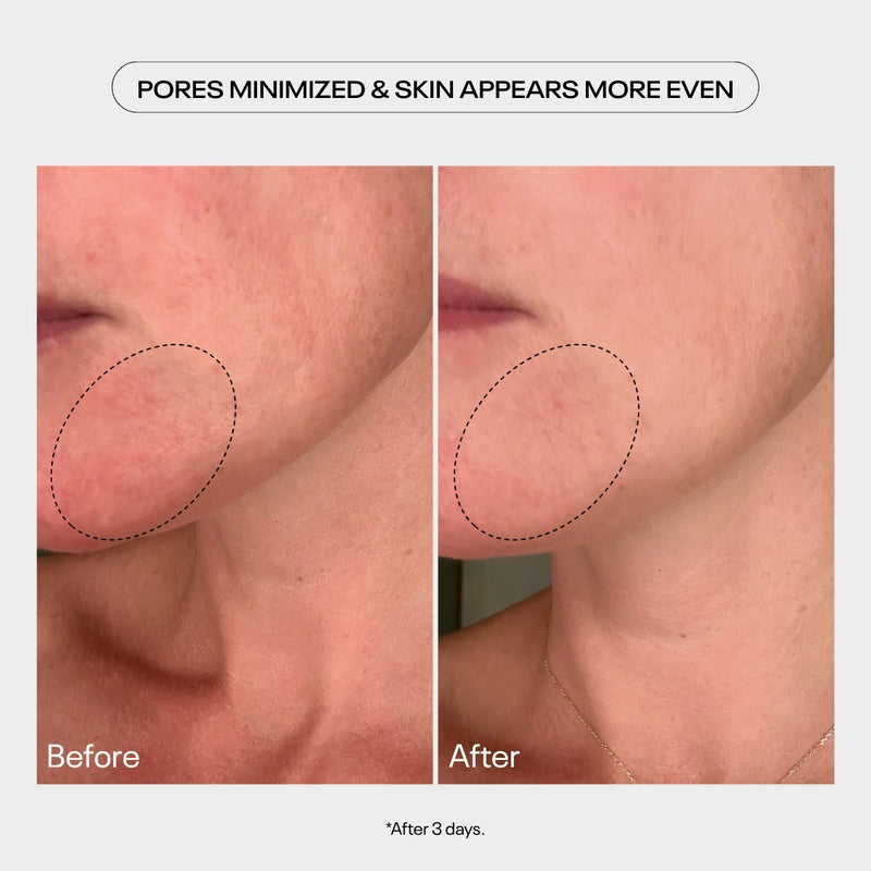 AHA Moment Double Action Resurfacing Serum