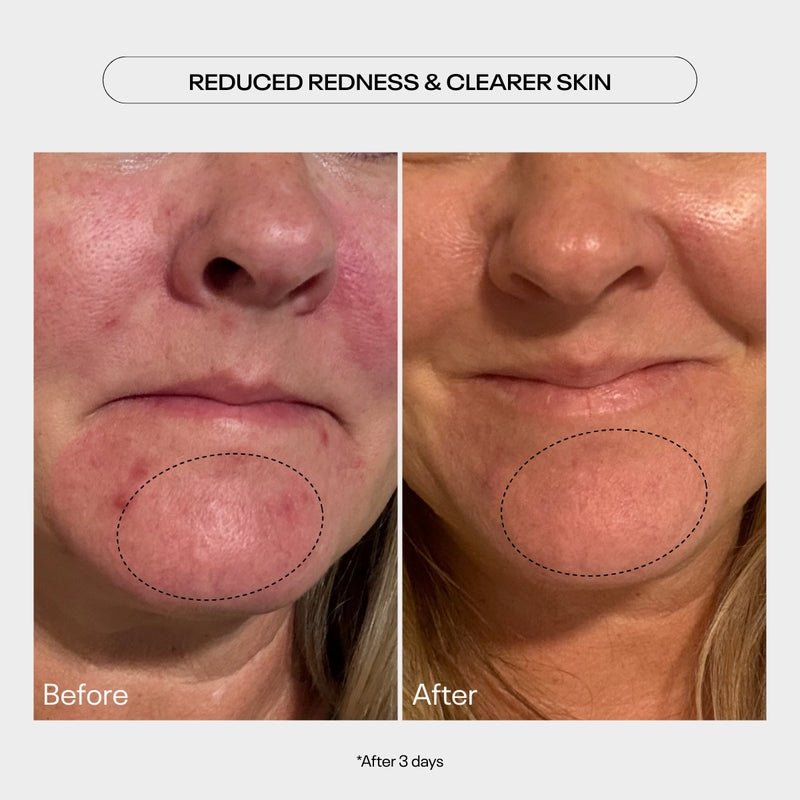 AHA Moment Double Action Resurfacing Serum